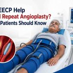 Can EECP Help Avoid Repeat Angioplasty? What Patients Should Know